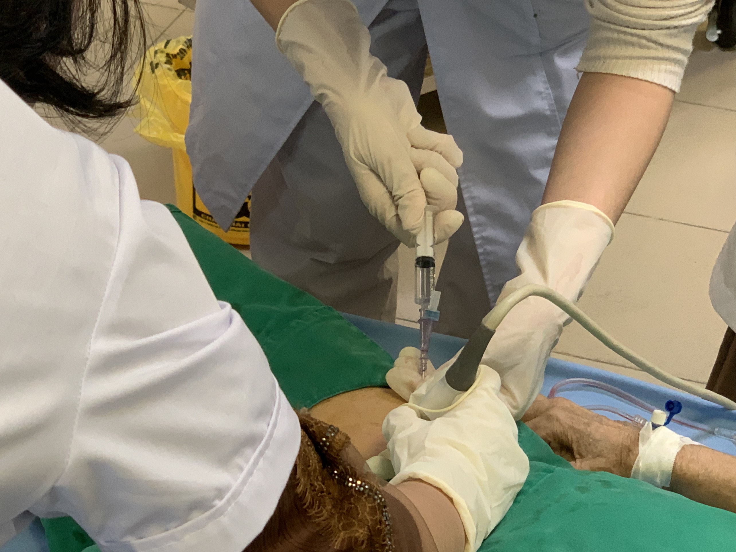 TTYT huyện Tiên Du áp dụng thành công phương pháp  điều trị lọc máu cấp cứu qua Catheter tĩnh mạch đùi 